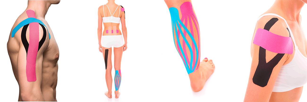 Kieziologiai tapasz Kieziologiai tapasz